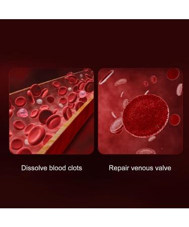 Varicose Veins & Muscle Relief Cream - Professional Treatment for Legs, Phlebitis Relief - Buy Online on GoSupps.com