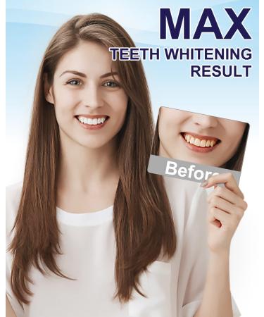 MySmile Teeth Whitening Kit - 6 Month Supply Non-Sensitive Teeth Whitener Pen - Removes Coffee, Smoking, Wine, Soda, Tea Stains in Just 10 Minutes - Buy Online on GoSupps.com