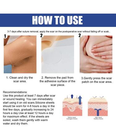 MIXCUT Silicone Scar Sheets for Breast Reduction Surgery - 8 Pack Scar Removal Strips: 4 Areola Soft Strips & 4 Anchor Sheets - Buy Online on GoSupps.com