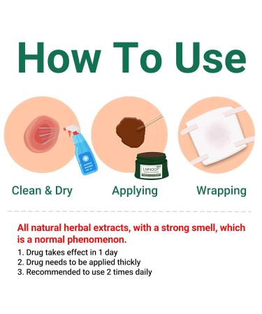 LMNOOP Perianal Care Cream - Fast Healing Treatment for Anus Fissure, Abscess, Ulcer, Infection, Postpartum & Anal Fistula Surgery - 1.1 Ounce (Pack of 1) - Buy Online on GoSupps.com