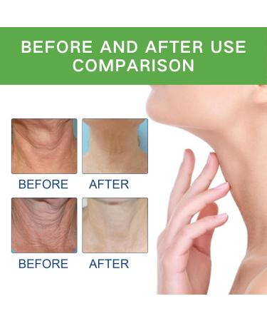 Neck Firming Cream Tighten and Lift Neck Cream Neck Line Remover Neck Tightening and Firming Vitamin C Vitamin E Moisturizing Anti Aging Reduce Neck Fine Lines Improve Roughness - Buy Online on GoSupps.com