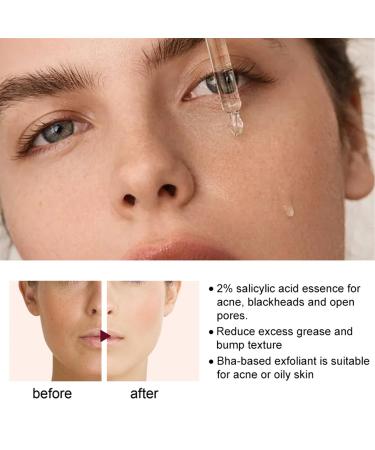 Rozino 3PC Face Serum Set | Advanced Collagen Boost Anti-Aging Solution for Glowing Skin - Buy Online on GoSupps.com