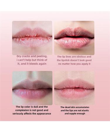 5 Color Lip Mask Set Lip Masks for Dry Lips Lip Repair Mask with Propolis and Vitamin E. - Buy Online on GoSupps.com