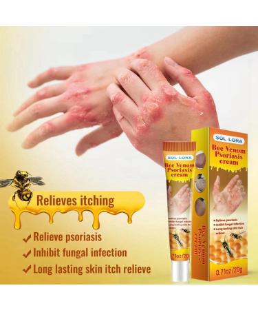 Bee Veno-m Body Cream for Skin Itchiness Smoothing Body Cream for Skin Redness Relieve Skin Itching & Long Lasting Hydration - Buy Online on GoSupps.com