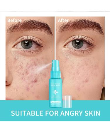 Daily Rescue Facial Spray Hypochlorous Acid Spray Reduce Redness and Breakouts 100% Natural Fragrance Free Alcohol Free Oil Free Cruelty Free Vegan (1) - Buy Online on GoSupps.com