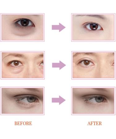 Eye Essence Firming Eye Cream Remove Eye Bag Creams - Buy Online on GoSupps.com