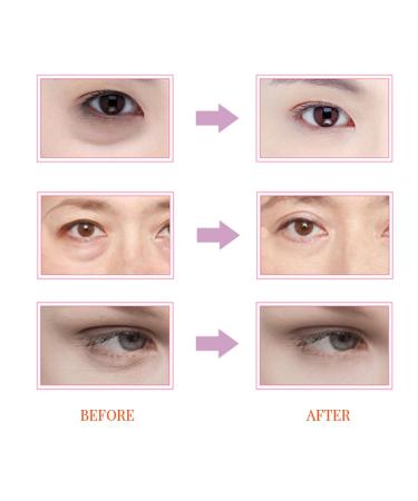 Best Eye Cream for Dark Circles & Bags | Instant Eye Bag Treatment for Men & Women - Buy Online on GoSupps.com