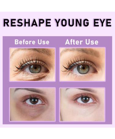 KOEC Retinol Firming Eye Cream for Dark Circles & Puffiness & Wrinkles Under Eye Cream with Massage Roller to Reduce Fine Lines Smooth and Firm Skin 20ml - Buy Online on GoSupps.com