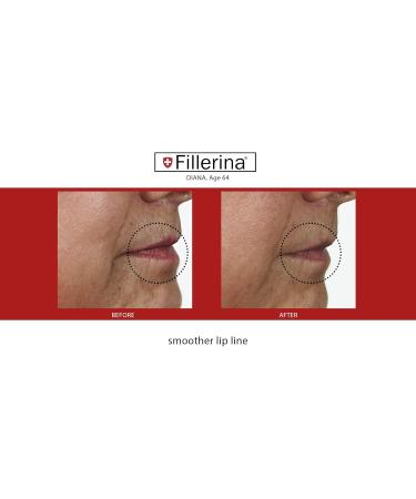 Fillerina Lip Volume Grade 2 5ml - Buy Online on GoSupps.com
