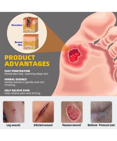 DUBUSH Bed Wound Treatment Cream Bed Wound Healing Cream Rapid Wound Healing Gel Pressure Wound Relief Cream Decubitus Wound - Buy Online on GoSupps.com