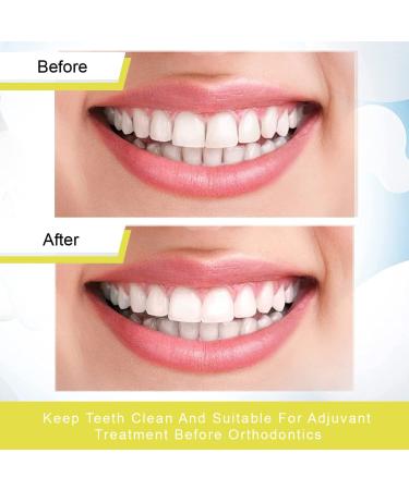 Cuhza Tooth Grinding Paper - Ultra-Fine Dental Polishing Strips 20 m 4mm Width Interdental Grinding Tool for Perfect Teeth Care - Ships Internationally - Buy Online on GoSupps.com