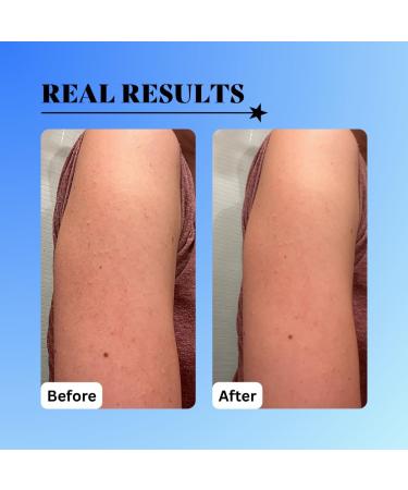 10% Glycolic Exfoliating Treatment Tonic (1oz) 1 Ounce (Pack of 1) - Buy Online on GoSupps.com