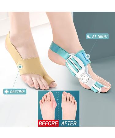 DOJUNS Bunion Corrector & Toe Separator - Orthopedic Splint for Pain Relief in Women & Men - Day Support - Buy Online on GoSupps.com