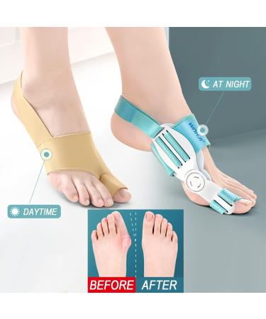 DOJUNS Bunion Corrector & Toe Separator - Orthopedic Bunion Splint for Pain Relief | Day & Night Support for Men & Women - Buy Online on GoSupps.com