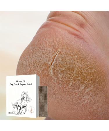 Horse Oil Dry Crack Repair Patch foot cream for dry cracked heels and feet Horse Oil foot balm repairing cream for knees elbows and hands Hands - Buy Online on GoSupps.com