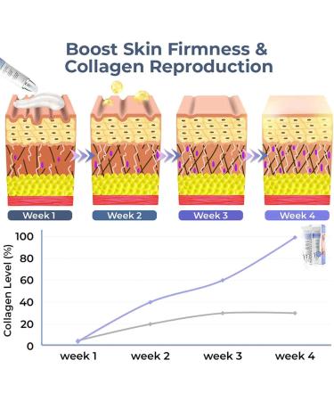 WLJEHWLJ Retinol Eye Cream with Collagen Fast Act Collagen Firming Eye Cream Hyaluronic Acid to Eliminate Dark Circles Puffiness and Bags Under Eyes - Buy Online on GoSupps.com