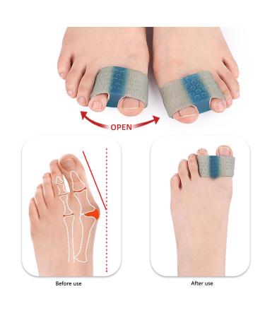 Saluaqui 4-Pack Toe Separator Corrector for Hallux Valgus - Prevent Overlap Reusable & Comfortable Solution for Overlapping Toes - Buy Online on GoSupps.com