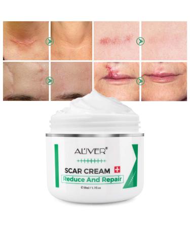 Scar Removal Cream for Old Scars, Stretch Marks & Burns - Natural Skin Repair for Acne Scars & Spots - Buy Online on GoSupps.com