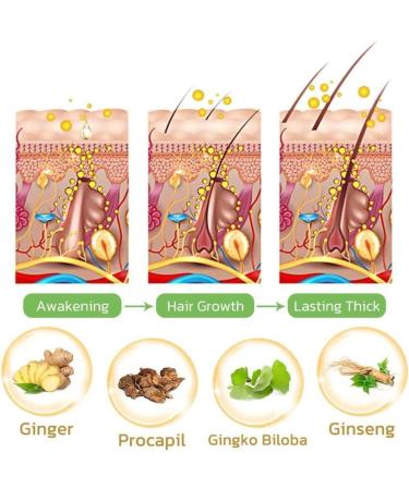 Ginger Shampoo Bar. Ginger Shampoo Soap for Men and Women (2PCS) - Buy Online on GoSupps.com