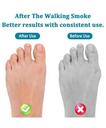 Roinaaid Hammer Toe Correction - 6 Pairs of Cushions & Gentle Relief for Claw Toes - Buy Online on GoSupps.com