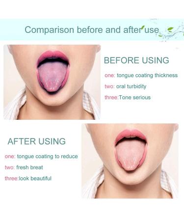 Adult Tongue Scraper Cleaner - Fresh Breath Tongue Brush (6 Pack, Random Color) - Buy Online on GoSupps.com