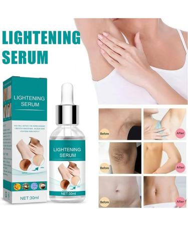Skin Whitening Serum Skin Lightening Serum For Body Underarms Armpit Knees and Inner Thigh Dark Spot Remover Corrector Cream for Body Hyperpigmentation Treatment 1 - Buy Online on GoSupps.com
