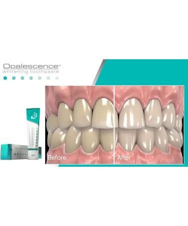 Opalescence Sensitivity Relief Whitening Toothpaste - Intense Whitening & Gentle Care for Sensitive Teeth - Shop Internationally - Buy Online on GoSupps.com