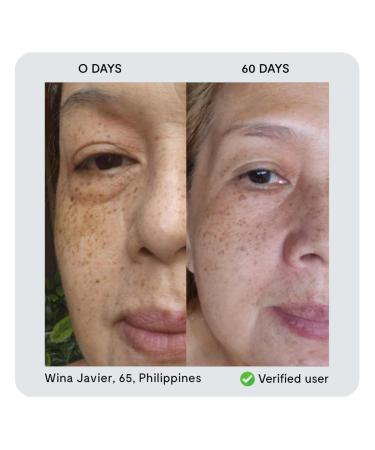 nor sken Reverse-aging Natural Vegan Facial Cream to Increase Skin Elasticity and Collagen Decrease Wrinkles and Redness - Buy Online on GoSupps.com