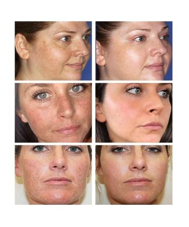 Snail Mucin 97% Daily Face Moisturizer Cream - High Potency Hydration | Korean Skincare for Glowing Skin - Buy Online on GoSupps.com