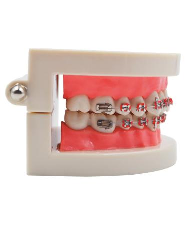 Standard Tooth Teaching Model for Orthodontics | Mallocclusion Teeth with Brackets Archwire & Buccal Tube - Perfect for Dental Education - Buy Online on GoSupps.com