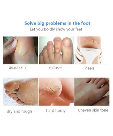 Onkessy Foot Peel Mask - Exfoliating Dead Skin Feet Repair Treatment - For Men and Women - Pedicure Spa - 1 Pair - Buy Online on GoSupps.com