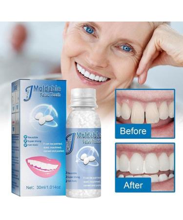 40g Temporary Tooth Repair Kit - Denture Glue for Halloween Cosplay & Film | Instant Tooth Fix - Buy Online on GoSupps.com