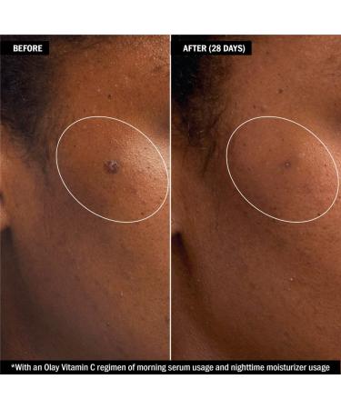 Olay Regenerist Vitamin C & Peptide 24 Face Moisturizer Gift Set - Travel Size Whip Moisturizer - Buy Online on GoSupps.com