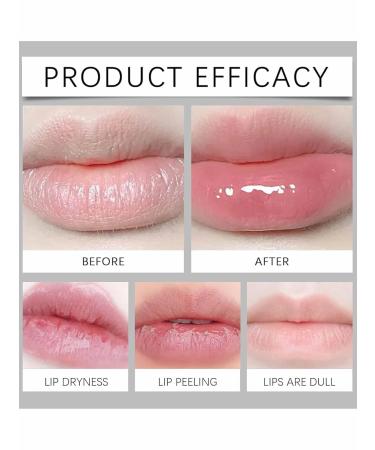 Belani Fordyce Lip Cream Long-Lasting Moisture Care for Lips Replenishes Moisture and Changes Lip Texture (1) - Buy Online on GoSupps.com
