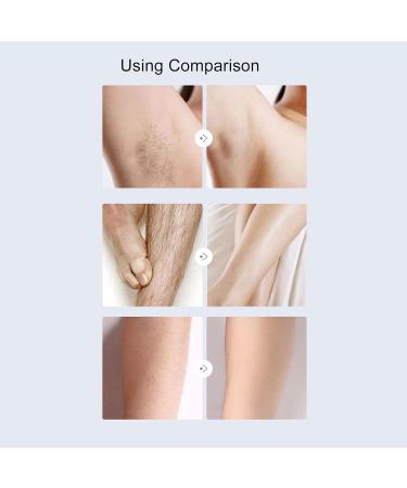 Nose Hair Trimmer 3-in-1 Rechargeable Grooming Kit for Men & Women | Electric Ear & Nose Shaver - Wet/Dry Use - Buy Online on GoSupps.com