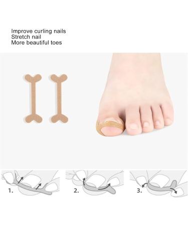 Toe Nail Growth Corrector Device Set Stainless Steel Ingrown Toenail Corrector Strips Kit for Pedicure - Buy Online on GoSupps.com