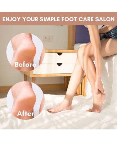 Makartt Colossal Foot File Scrubber - Professional Metal Pedicure Tool for Callus Removal and Dead Skin Care - Buy Online on GoSupps.com