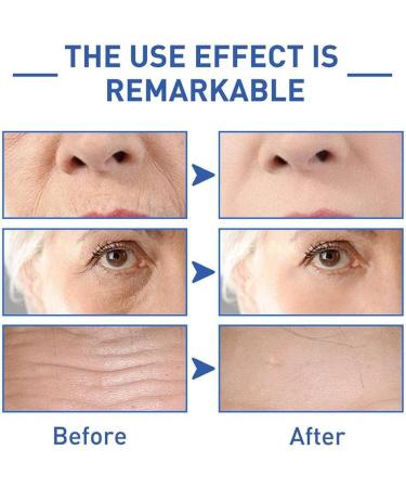 3Pcs SADOER Eye Cream SADOER Caffeine Retinol Moisturizing Anti-Wrinkle Cream Caffeine Eye Cream Reduces Wrinkles Fine Lines - Buy Online on GoSupps.com