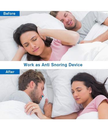 Adjustable 3-Speed Electric Anti-Snoring Device for Men and Women | Nasal Dilator for Better Sleep | Includes Fixing Strap | White - Buy Online on GoSupps.com
