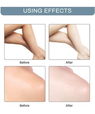 Cr me blanchissante instantan e 10 secondes pour aisselles aisselles correcteur de taches sombres et dissolvant pour genoux coudes parties sensibles (2 pi ces) - Buy Online on GoSupps.com