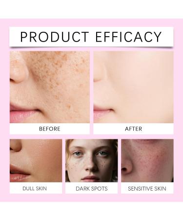 Arbutin 7% + Tranexamic Acid 4% Cream Face Cream for Dark Spots Freckle Blemishes Pigmentation Skin Care for Hyperpigmentation Treatment Suitable for all skin types (50G/1.76OZ) (1PC) - Buy Online on GoSupps.com