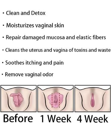 LJXWRF Annie Care Natural Detox Viginal Capsules & Gel - 3 Boxes (21 Pcs) - Annie Care - Buy Online on GoSupps.com