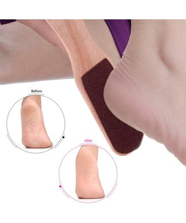 Gecheer Foot File Foot Rasp Hard Skin and Callus Remover Double Sided Foot File 2-way Pedicure Brush Foot File - Buy Online on GoSupps.com