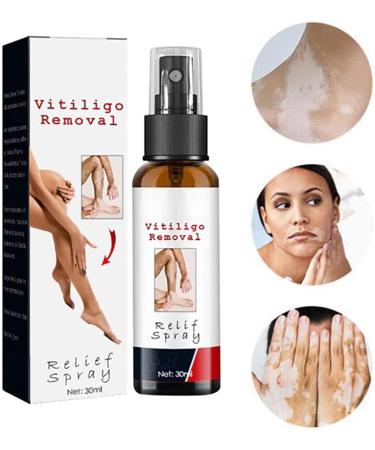 DUBUSH Vitiligo Kalmerende Spray Vitiligo Skin Repair Spray - Buy Online on GoSupps.com