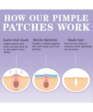 144 Pi ces Patch Bouton et 4 Patch Point Noir Nez Patchs Hydrocollo des Cache-Imperfections Invisibles Jour et Nuit limine Efficacement l'Acn et les Points Noirs pour Tous Types de Peau - Buy Online on GoSupps.com