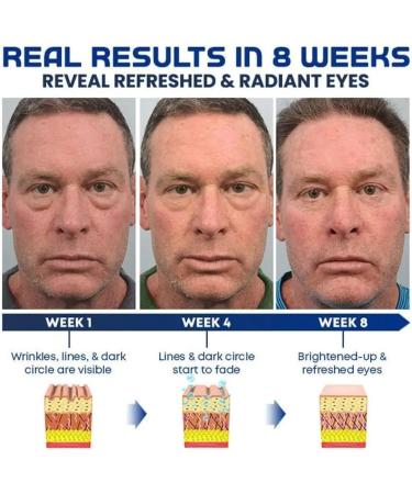 OPENEYES Awaken Peptide Lifting Eye Gel - Depuffing & Firming Formula for Brighter Eyes (1Pcs) - Buy Online on GoSupps.com