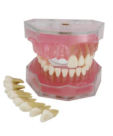 Samnuerly 28 Removable Teeth Dental Implant Model Translucent Standard Model for Research Teaching Removable Lower Jaw