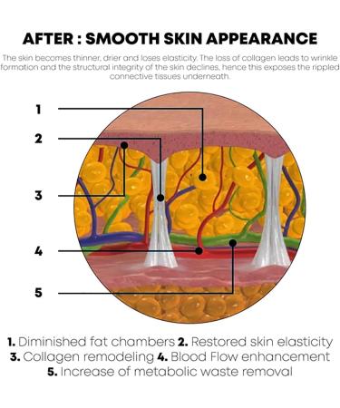 DUBUSH Bodyslim Firming Gel Body Shaping Cream Firming Body Cream Firming Tummy Anti Cellulite Firming Loose Skin - Buy Online on GoSupps.com
