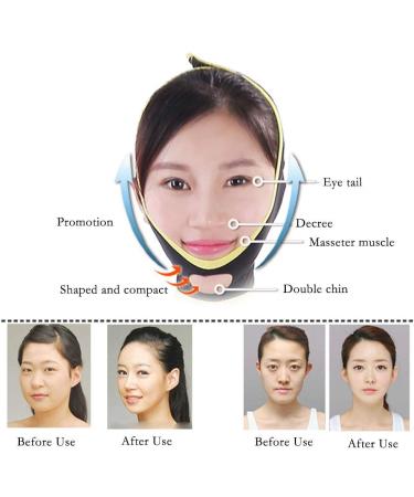 Perfect Face Slimming V-Line Belt | Kinnbacke Anti-Wrinkle Mask | Ultra Breathable Facial Band for Mama | Best Gift for a Youthful Look - Buy Online on GoSupps.com