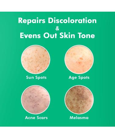 Dark Spot Remover Serum for Face - Skin Lightening & Brightening Treatment | Melasma, Hyperpigmentation & Sun Spot Remover with Synovea, 4-Butylresorcinol, Niacinamide & Kojic Acid - Buy Online on GoSupps.com